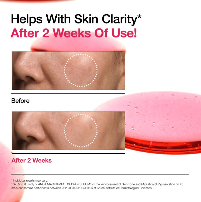Niacinamide 10 TXA 4 Radiance Serum