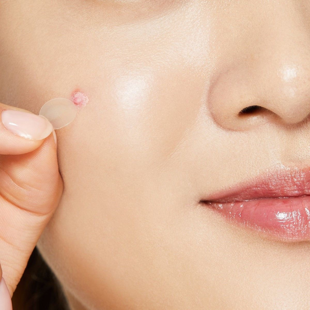 Cosrx Acne Patch (Sheet)